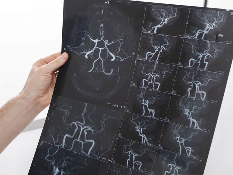Patología vascular